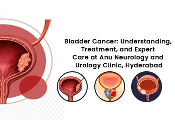 Bladder Cancer